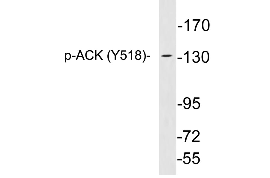 Western Blot - Anti-ACK (phospho Tyr518) Antibody (P12-1001) - Antibodies.com