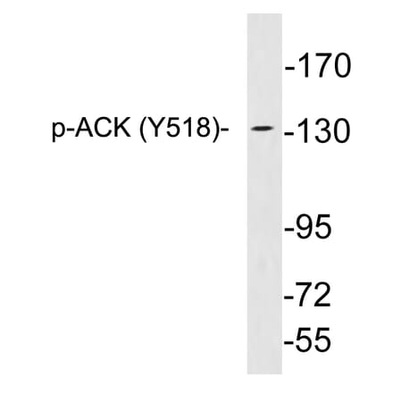 Western Blot - Anti-ACK (phospho Tyr518) Antibody (P12-1001) - Antibodies.com