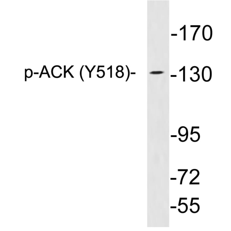 Western Blot - Anti-ACK (phospho Tyr518) Antibody (P12-1001) - Antibodies.com