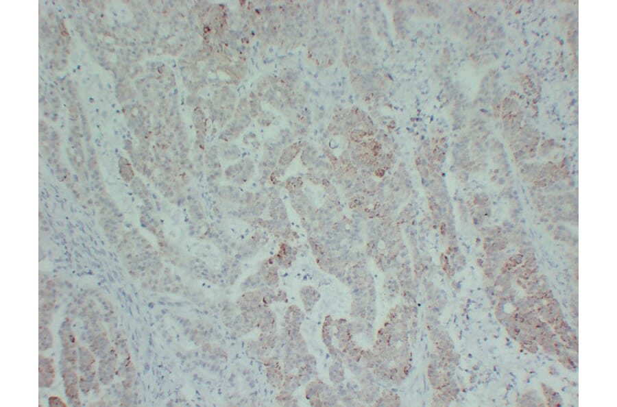 Immunohistochemistry - Anti-TGF beta Receptor II Antibody (V0130) - Antibodies.com