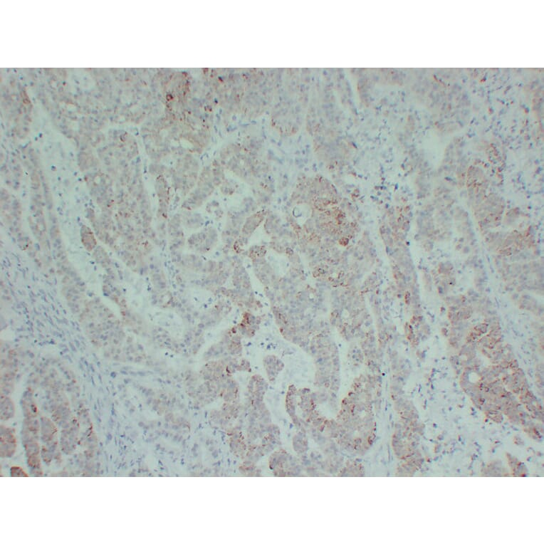 Immunohistochemistry - Anti-TGF beta Receptor II Antibody (V0130) - Antibodies.com