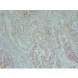 Immunohistochemistry - Anti-TGF beta Receptor II Antibody (V0130) - Antibodies.com