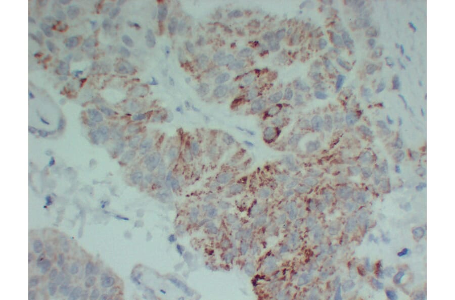 Immunohistochemistry - Anti-TGF beta Receptor II Antibody (V0130) - Antibodies.com