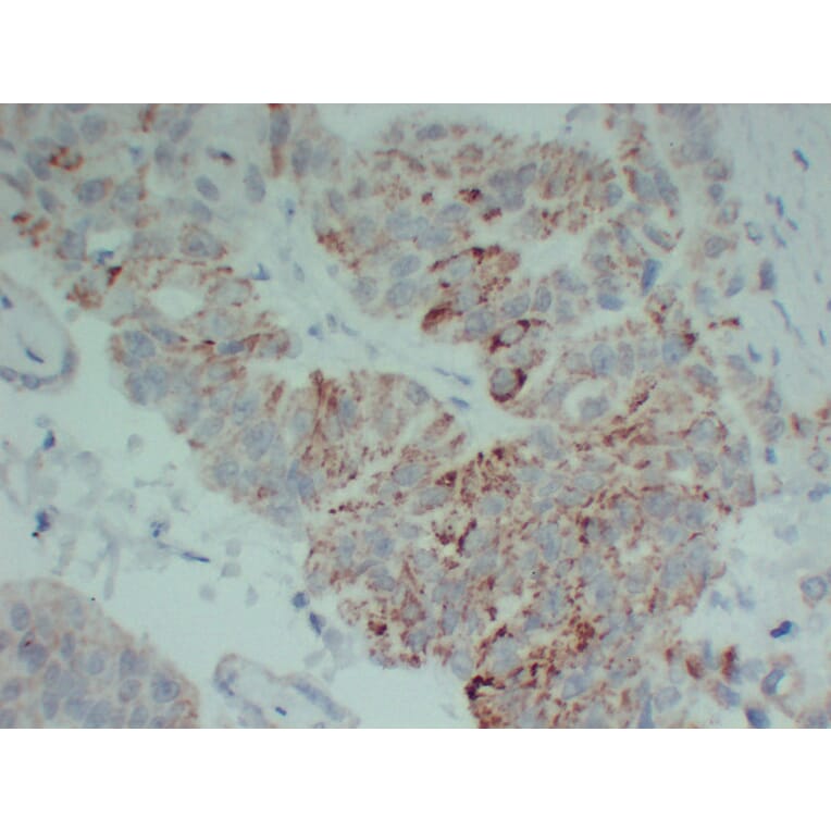 Immunohistochemistry - Anti-TGF beta Receptor II Antibody (V0130) - Antibodies.com