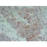 Immunohistochemistry - Anti-TGF beta Receptor II Antibody (V0130) - Antibodies.com