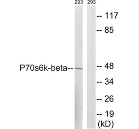 Western Blot - Anti-p70 S6 Kinase beta Antibody (B8157) - Antibodies.com
