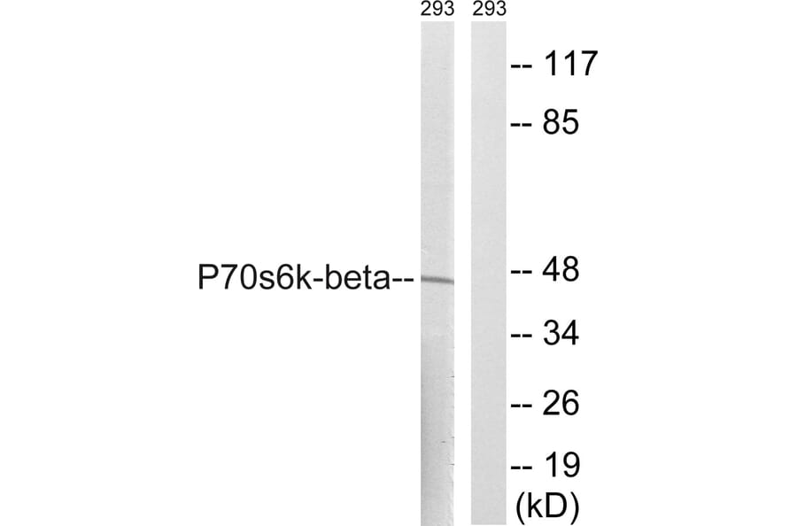 Western Blot - Anti-p70 S6 Kinase beta Antibody (B8157) - Antibodies.com