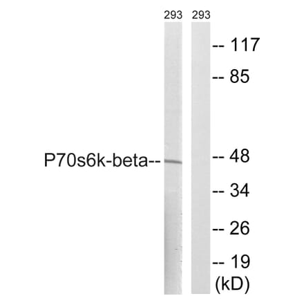 Western Blot - Anti-p70 S6 Kinase beta Antibody (B8157) - Antibodies.com