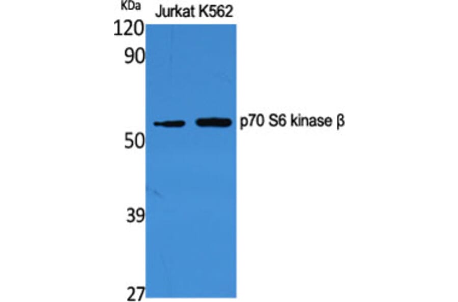 Western Blot - Anti-p70 S6 Kinase beta Antibody (B8157) - Antibodies.com