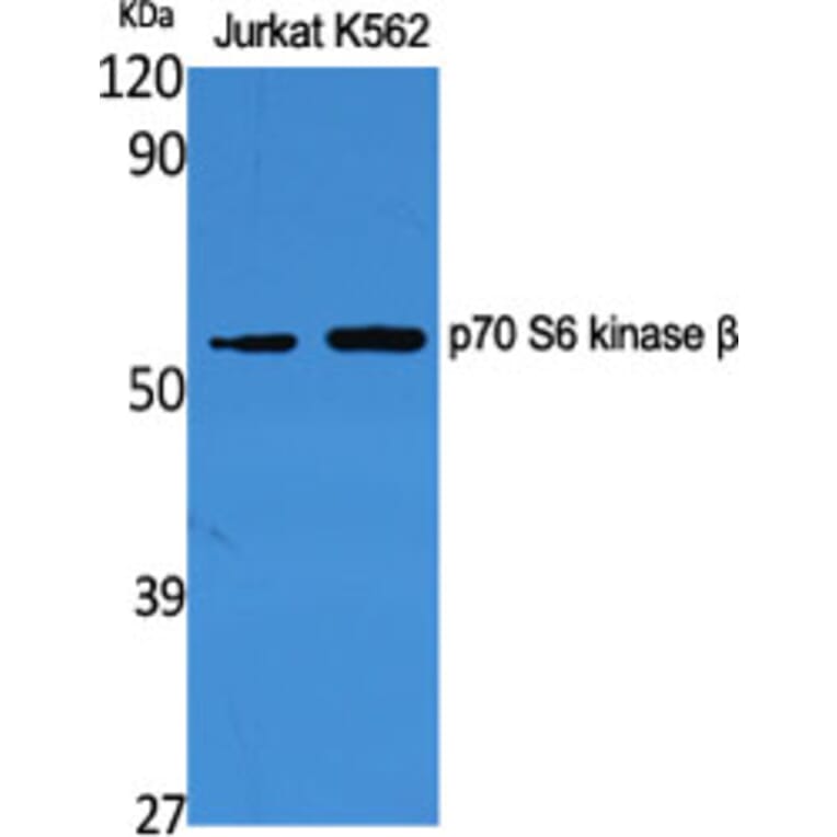 Western Blot - Anti-p70 S6 Kinase beta Antibody (B8157) - Antibodies.com