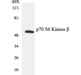 Western Blot - Anti-p70 S6 Kinase beta Antibody (R12-3292) - Antibodies.com
