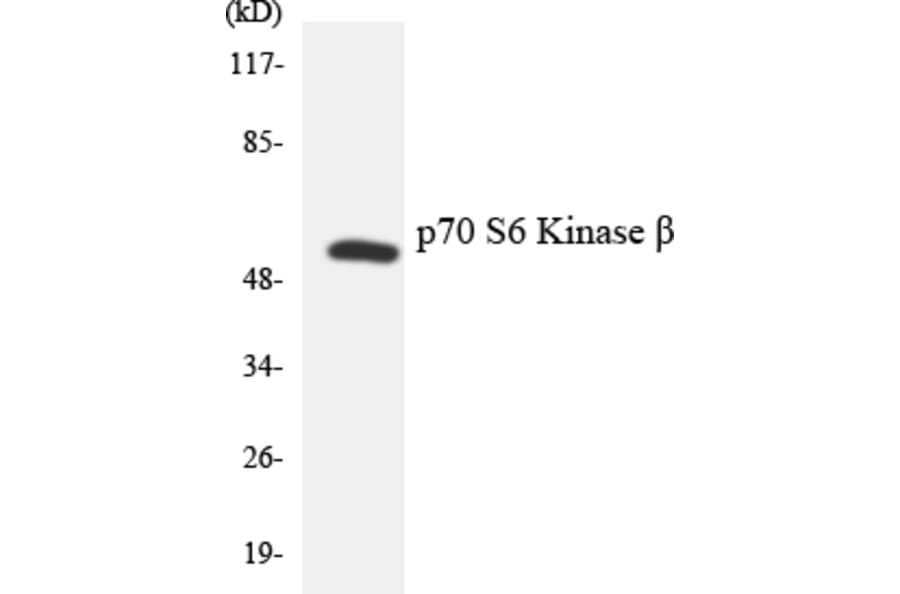 Western Blot - Anti-p70 S6 Kinase beta Antibody (R12-3292) - Antibodies.com