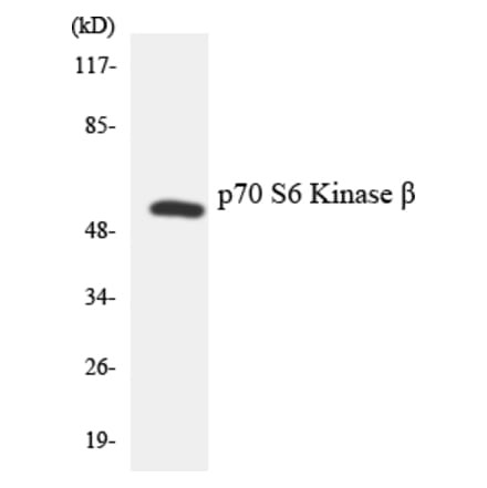 Western Blot - Anti-p70 S6 Kinase beta Antibody (R12-3292) - Antibodies.com
