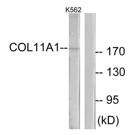 Western Blot - Anti-Collagen XI alpha1 Antibody (C12214) - Antibodies.com