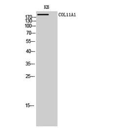 Western Blot - Anti-Collagen XI alpha1 Antibody (C12214) - Antibodies.com