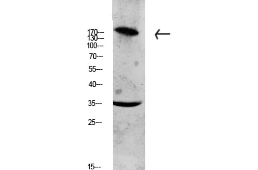 Western Blot - Anti-Collagen XI alpha1 Antibody (C12214) - Antibodies.com