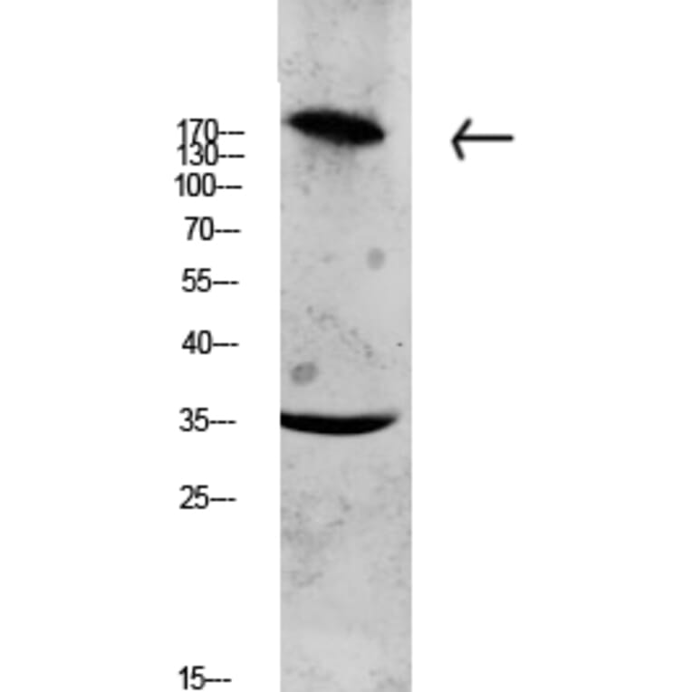 Western Blot - Anti-Collagen XI alpha1 Antibody (C12214) - Antibodies.com