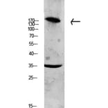 Western Blot - Anti-Collagen XI alpha1 Antibody (C12214) - Antibodies.com