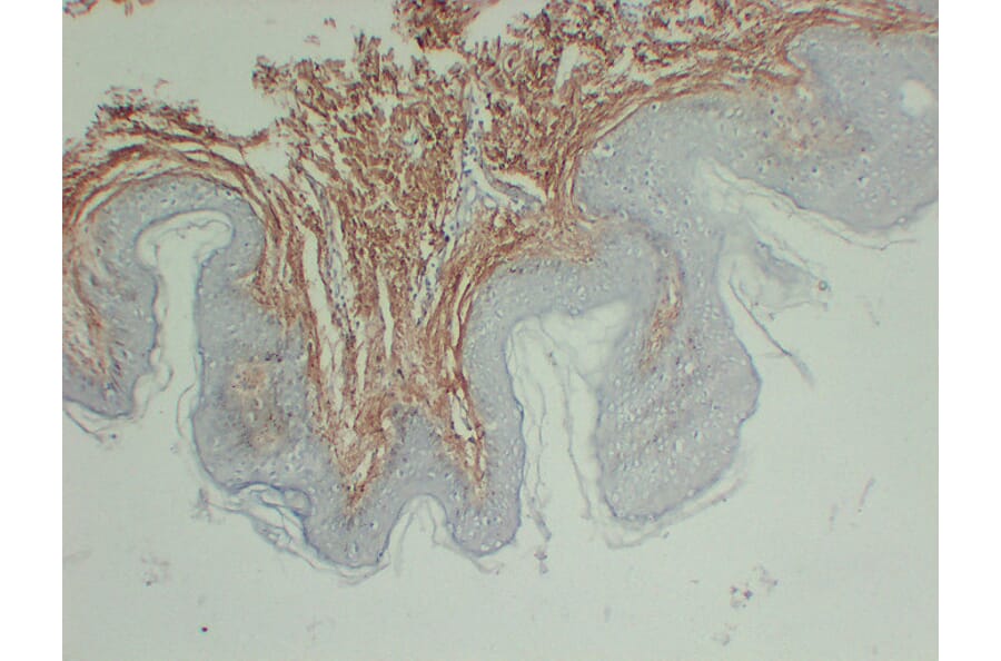 Immunohistochemistry - Anti-Collagen Type III Antibody (V0064) - Antibodies.com