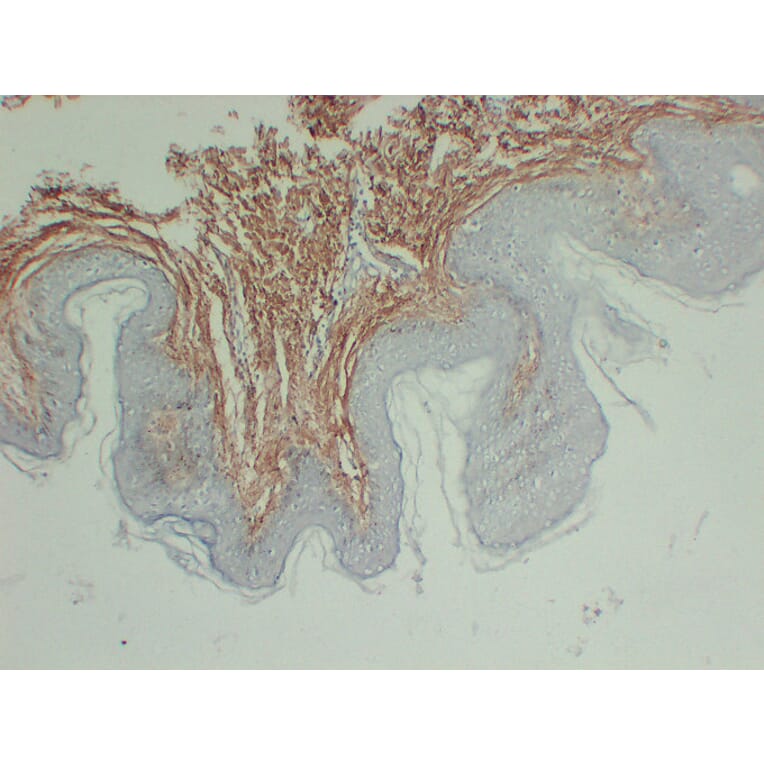 Immunohistochemistry - Anti-Collagen Type III Antibody (V0064) - Antibodies.com