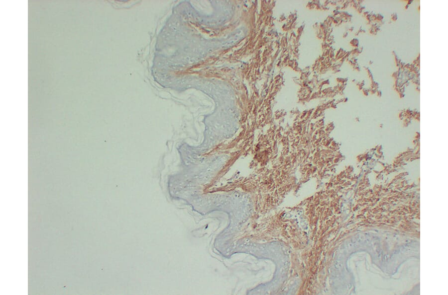 Immunohistochemistry - Anti-Collagen Type III Antibody (V0064) - Antibodies.com