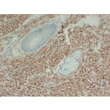 Immunohistochemistry - Anti-Collagen Type III Antibody (V0064) - Antibodies.com