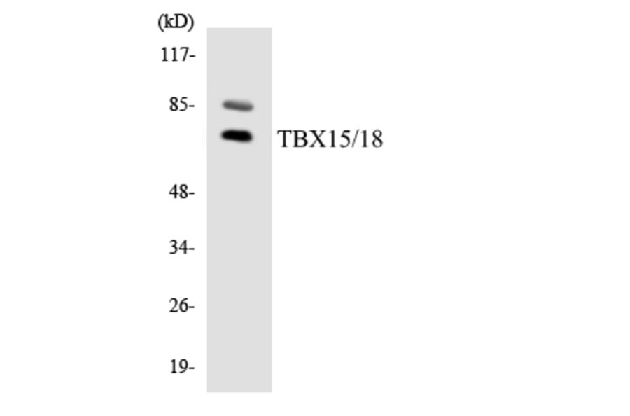 Western Blot - Anti-TBX15 + TBX18 Antibody (R12-3604) - Antibodies.com