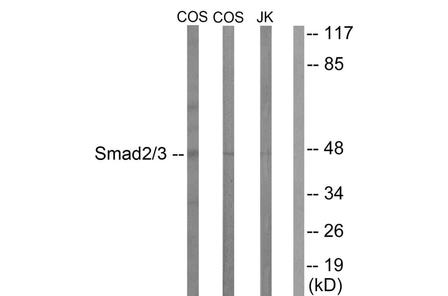 Western Blot - Anti-Smad2 + Smad3 Antibody (B1001) - Antibodies.com