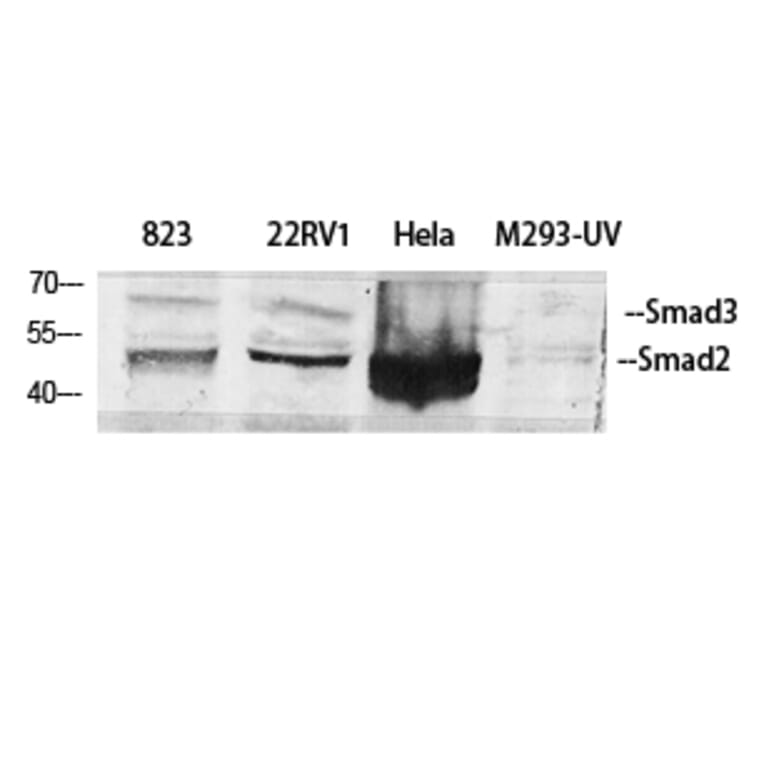 Western Blot - Anti-Smad2 + Smad3 Antibody (B1001) - Antibodies.com