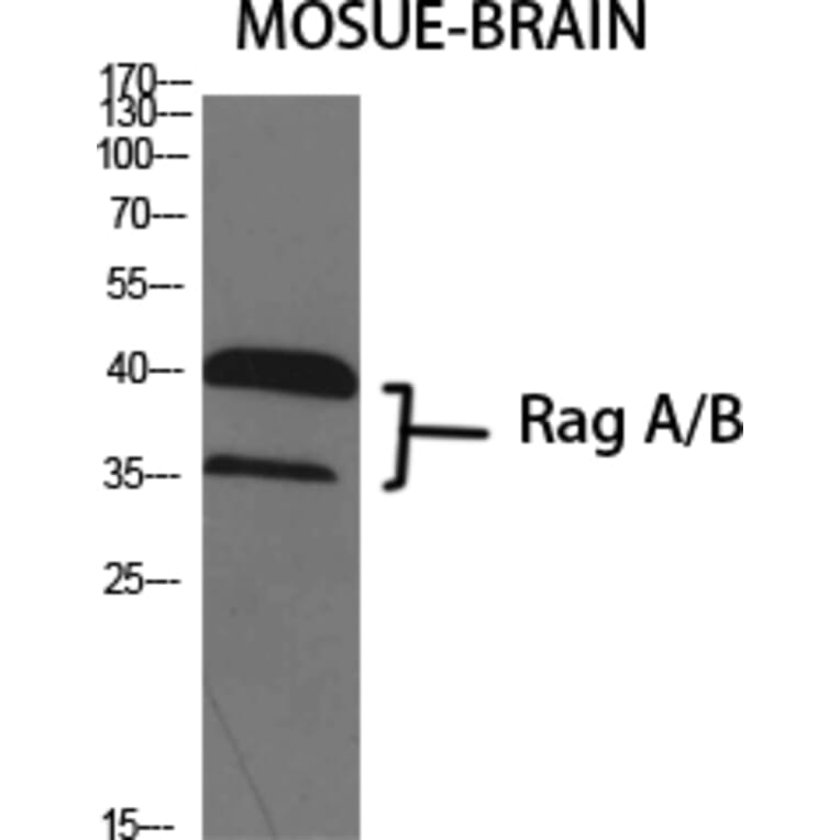 Western Blot - Anti-RRAGA + RRAGB Antibody (C18211) - Antibodies.com
