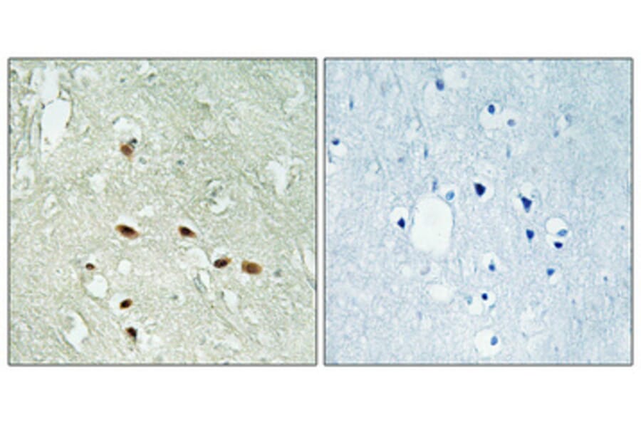 Immunohistochemistry - Anti-RRAGA + RRAGB Antibody (C18211) - Antibodies.com