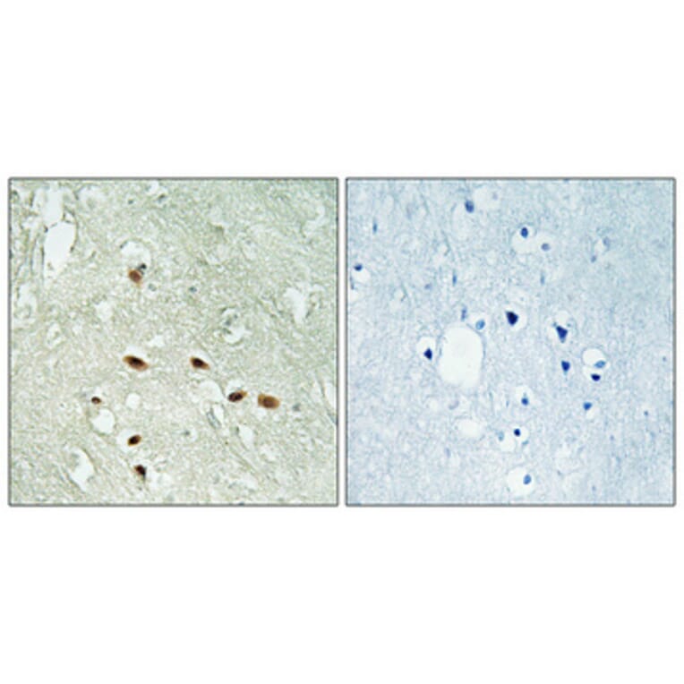 Immunohistochemistry - Anti-RRAGA + RRAGB Antibody (C18211) - Antibodies.com