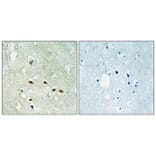 Immunohistochemistry - Anti-RRAGA + RRAGB Antibody (C18211) - Antibodies.com