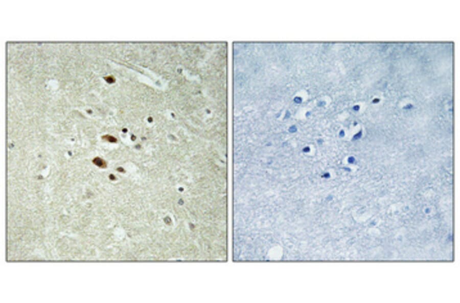Immunohistochemistry - Anti-RRAGA + RRAGB Antibody (C18211) - Antibodies.com