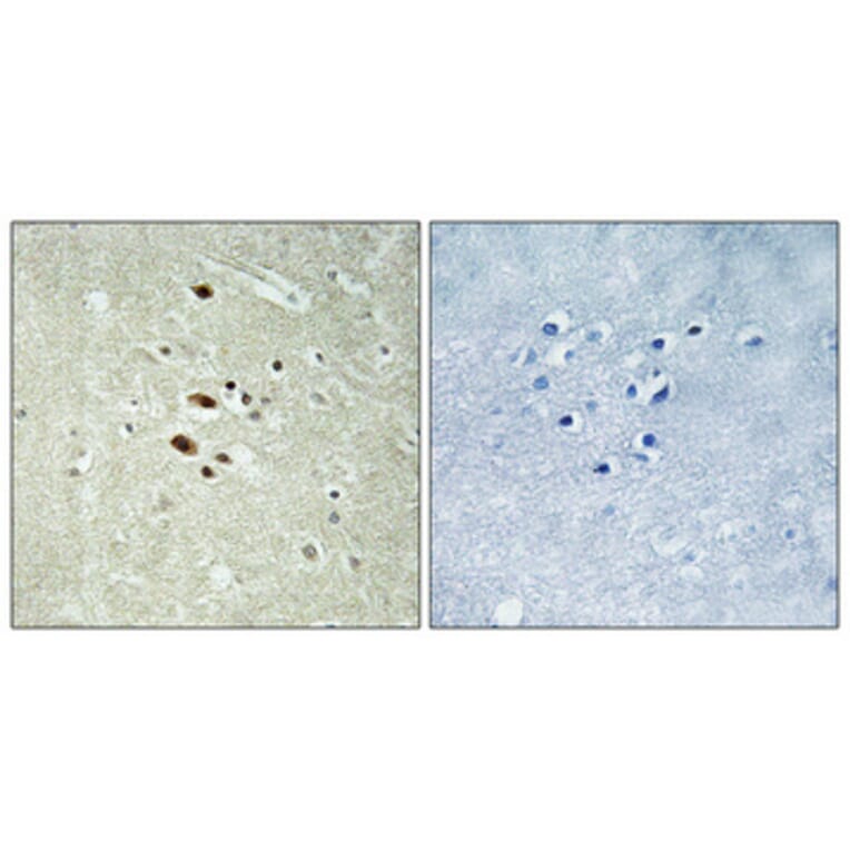Immunohistochemistry - Anti-RRAGA + RRAGB Antibody (C18211) - Antibodies.com