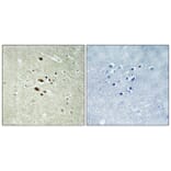 Immunohistochemistry - Anti-RRAGA + RRAGB Antibody (C18211) - Antibodies.com