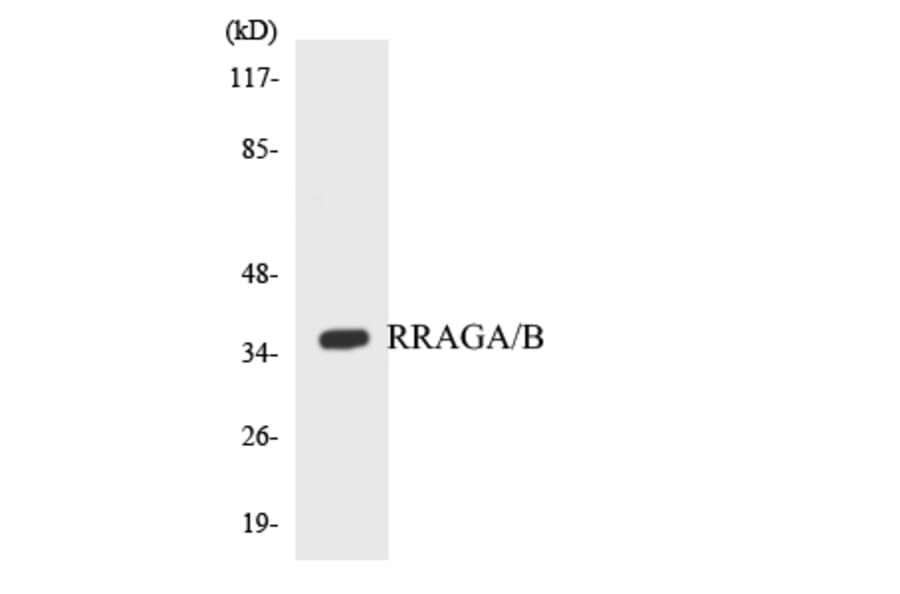 Western Blot - Anti-RRAGA + RRAGB Antibody (R12-3468) - Antibodies.com