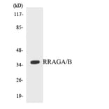 Western Blot - Anti-RRAGA + RRAGB Antibody (R12-3468) - Antibodies.com