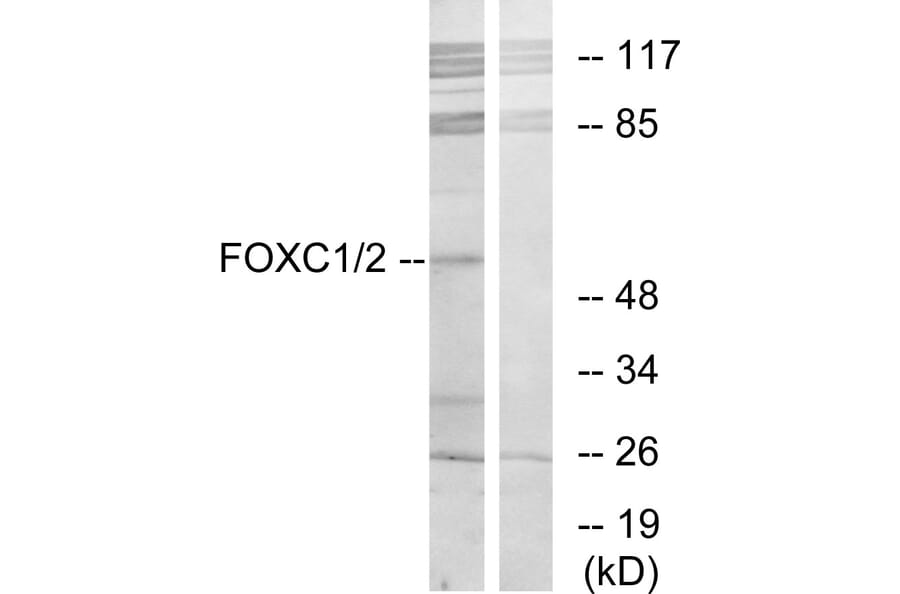 Western Blot - Anti-FOXC1 + FOXC2 Antibody (C10937) - Antibodies.com
