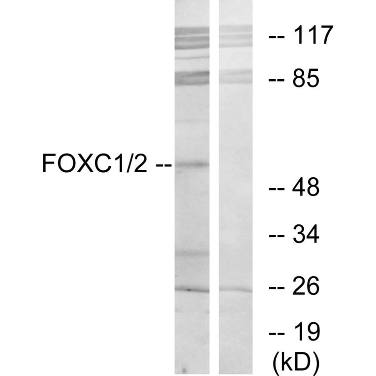 Western Blot - Anti-FOXC1 + FOXC2 Antibody (C10937) - Antibodies.com