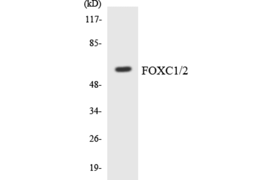 Western Blot - Anti-FOXC1 + FOXC2 Antibody (R12-2774) - Antibodies.com
