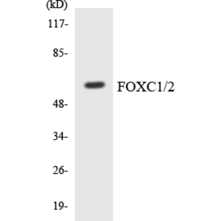 Western Blot - Anti-FOXC1 + FOXC2 Antibody (R12-2774) - Antibodies.com