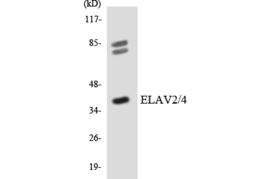 Western Blot - Anti-ELAV2 + ELAV4 Antibody (R12-2743) - Antibodies.com