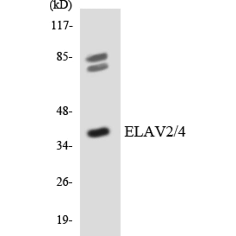 Western Blot - Anti-ELAV2 + ELAV4 Antibody (R12-2743) - Antibodies.com