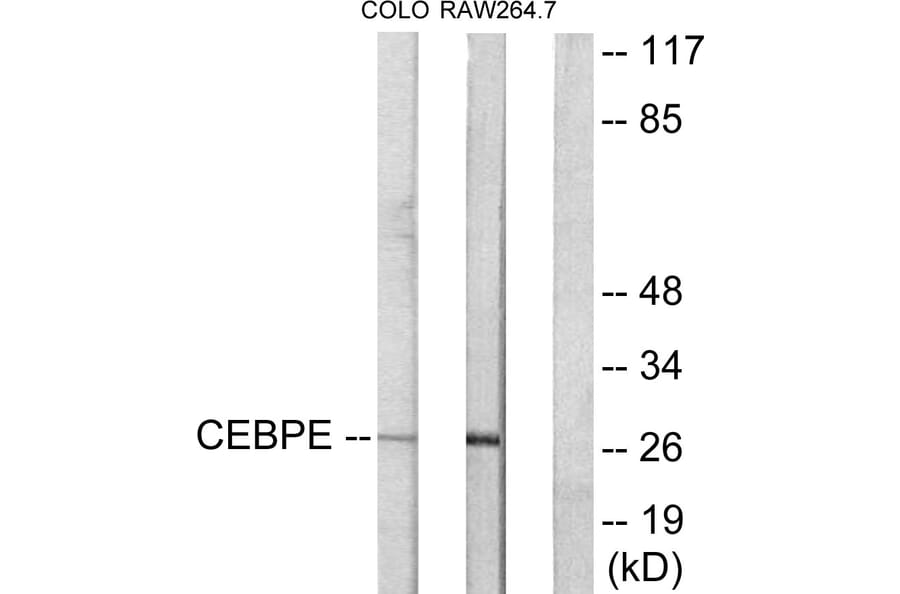Western Blot - Anti-CEBPD + CEBPE Antibody (C10650) - Antibodies.com