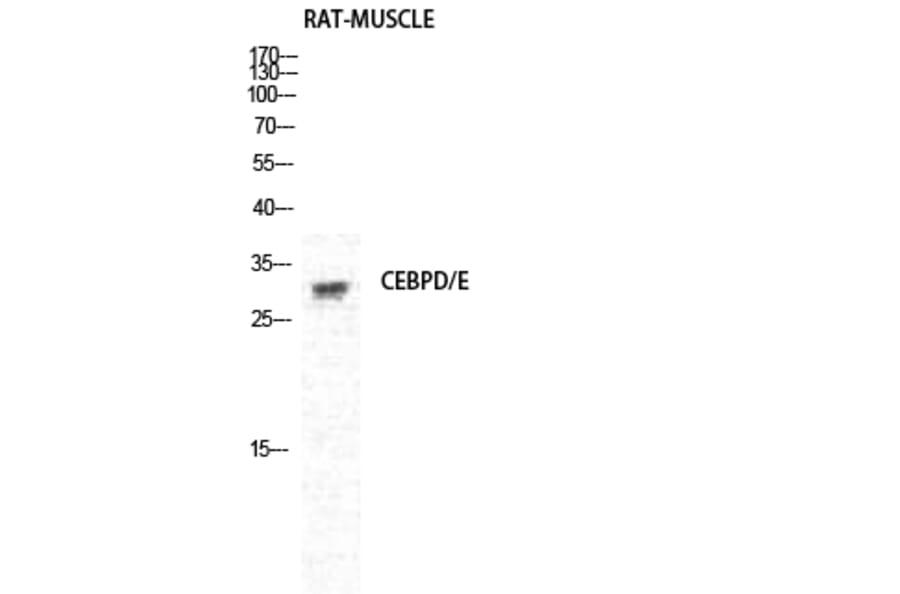 Western Blot - Anti-CEBPD + CEBPE Antibody (C10650) - Antibodies.com