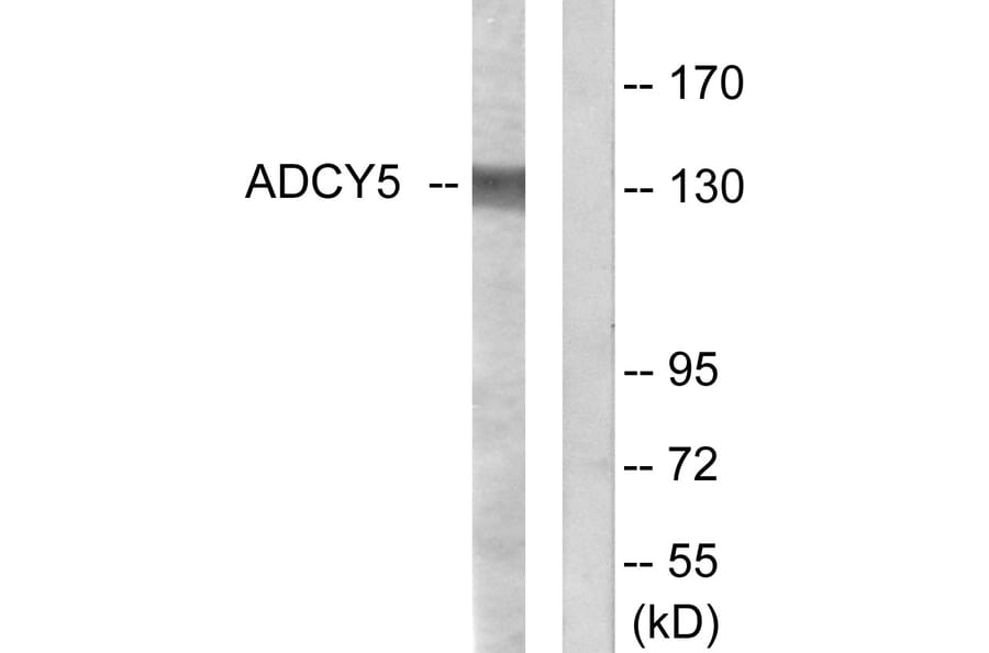 Western Blot - Anti-ADCY5 + ADCY6 Antibody (C12035) - Antibodies.com