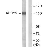 Western Blot - Anti-ADCY5 + ADCY6 Antibody (C12035) - Antibodies.com