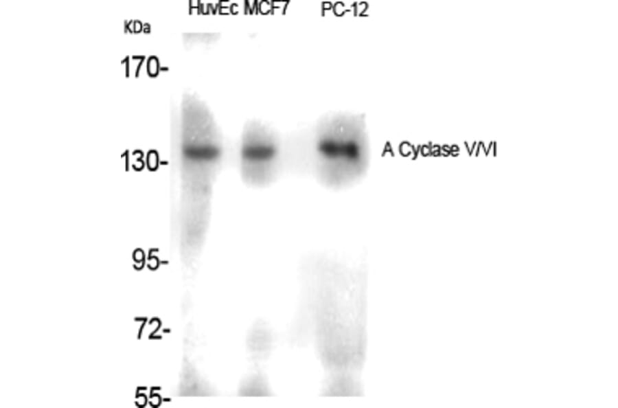 Western Blot - Anti-ADCY5 + ADCY6 Antibody (C12035) - Antibodies.com