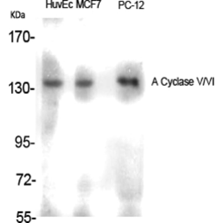 Western Blot - Anti-ADCY5 + ADCY6 Antibody (C12035) - Antibodies.com
